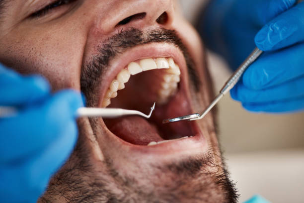 Best Emergency Dental Surgery in Woodbine, GA