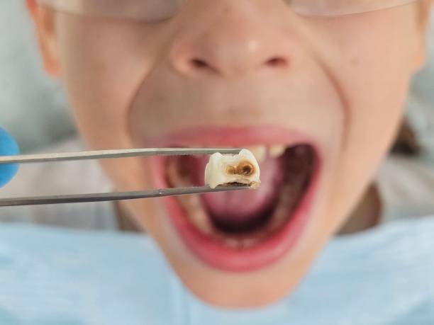 Best Emergency Broken Tooth Repair in Woodbine, GA